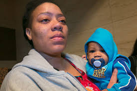 Right to Birth: Pressure