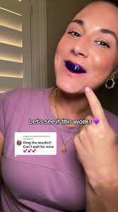 Purple Teeth Whitening Strips Review from Purely White Deluxe