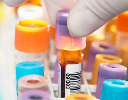 Seek treatment immediately, whatever the cause. Sodium Blood Test
