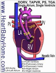 Pin On Heart Defect Images