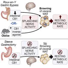 Nasterea naturala in sistemul privat are preturi care variaza de la un spital la altul. Endocannabinoid Receptor 1 And Sympathetic Nervous System Mediate The Beneficial Metabolic Effects Of Gastric Bypass Sciencedirect