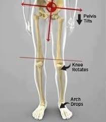 Pin Na Doske Knee Pain