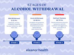 Image result for Alcohol Withdrawal