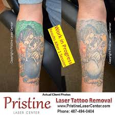 Our highly trained and experienced laser specialists are here to help. Pristine Laser Center Home Facebook