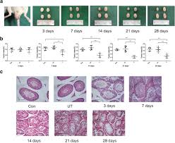 In unique cases, cryptorchidism can develop later in life, often as. Mir 34c Disrupts Spermatogonial Stem Cell Homeostasis In Cryptorchid Testes By Targeting Nanos2 Reproductive Biology And Endocrinology Full Text