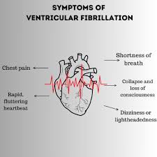 Image result for Ventricular Fibrillation Management in the Adult