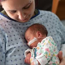 Image result for Preterm Infant