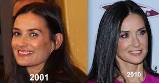 Worldwide and pam agullo, md. Demi Moore Plastic Surgery Demi Moore Zimbio