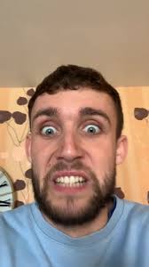 Irish Guy Comedy: Uncle Breaks His Leg Story