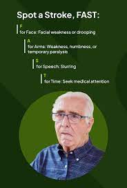 Stroke (Cerebral Vascular Accident): Symptoms, Treatment