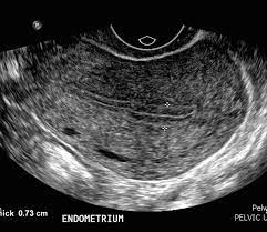 Hal itu disebabkan beberapa faktor. Facebook