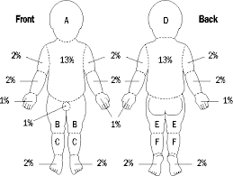 the clinical use of blood handbook burns assessing the