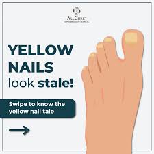 Image result for Yellow nail syndrome feet