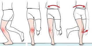 Image result for Thessaly Test