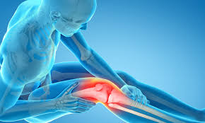 Knee replacement is a growing trend in the u.s. Beyond Pain Relief Total Knee Replacement Surgery Nih Medlineplus Magazine
