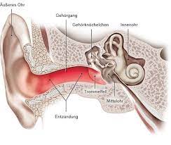 Gehorgangsentzundung Gesundheitsinformation De