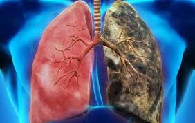 Check spelling or type a new query. Foods To Help You Detox Lungs After Quit Smoking