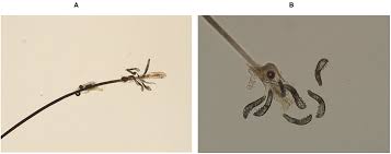 Image result for Demodex folliculorum