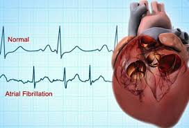 Pin On Medication And Procedures