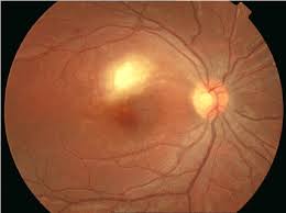 Image result for Chorisochora transvaalensis