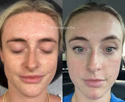 Jaclyn MSN, APRN, FNP-C💉 (@injectorjaclyn) • Instagram photos and videos