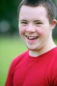 Data released today by the centers for disease control and prevention (cdc) on the according to the cdc's website , the cdc follows up on any report of death to request additional information and. Growth Charts For Children With Down Syndrome Cdc