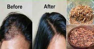 تجربتي مع بذرة الكتان لتكثيف الشعر في اقل من اسبوع فقط