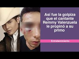 Jun 16, 2021 · el caso del cantante de regional mexicano ha dado la vuelta a las redes sociales por ser un serio caso de violencia. Fotos Remmy Valenzuela Es Acusado De Golpear Brutalmente A Su Primo Y A Su Novia Diario La Prensa