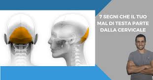 Mal Di Testa 7 Segnali Di Quando La Causa E Cervicale Come Risolvere