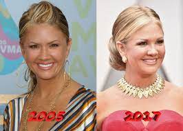 02.08.2016 · nancy o'dell wiki, husband, divorce, boyfriend and plastic surgery. Nancy O Dell Joins The List Of Plastic Surgery Stars