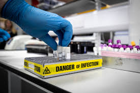 It was first identified in december 2019 in wuhan,. Private Labs Start Testing For Coronavirus Prompting Cost Concerns