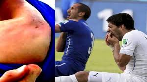 Uruguay'ın ve liverpool'un süper yıldızı luis suarez, ikili fifa, i̇talya maçında giorgio chiellini'yi ısıran uruguaylı forvet luis suarez hakkında soruşturma. Chiellini Holds No Suarez Grudge Despite 2014 World Cup Bite Your Ultimate Sports News Website