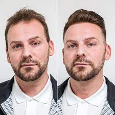 No two heads of hair are the same, and no two heads of hair start thinning the same way, but. 30 Classy Hairstyles For Men With Thin Hair Hairstyle On Point