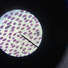 Check spelling or type a new query. Investigating Osmosis With Onion Cells Bangkok Prep