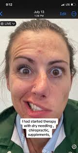 learningtosmileagain