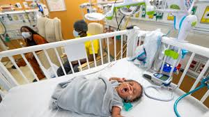 Image result for Preterm Infant