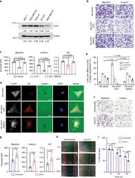 1 'faye' zhan wen ting. Ulk1 Phosphorylates Exo70 To Suppress Breast Cancer Metastasis Nature Communications