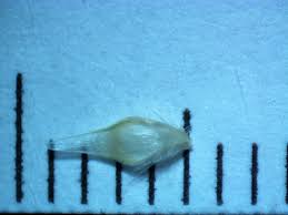 Image result for Rytidosperma davyi