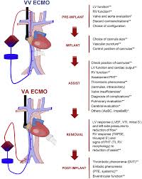Role of ultrasound in the critical ill patient with ECMO | Medicina  Intensiva
