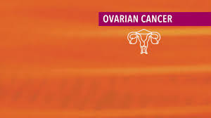 Ovarian cancer has a lifetime risk of around 2% for women in england and wales. Overview Of Ovarian Cancer Cancerconnect