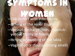 However, the infection is often asymptomatic. Trichomoniasis
