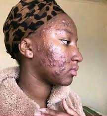 Destroys dementia, inflammation, pain, arthritis, osteoarthritis (Don't  spend more at the pharmacy)