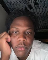 🚨Q & A? :¿How long does it take your skin to grow back