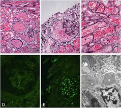 There are two general types of electron microscopes: Diagnostic Dilemmas In A Girl With Acute Glomerulonephritis Answers Springerlink