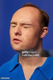 13,934 Downs Syndrome Male Stock Photos, High-Res Pictures, and Images