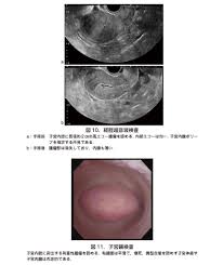 日本産婦人科医会