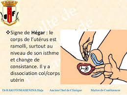 Je n'ai jamais lu d'articles sur ce sujet, et pourtant, quand un sujet gène la sexualité de millions de couples, on en. Diagnostic De Grossesse Au 1er Trimestre