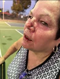 Introduction to Pickleball and Safety Precautions in North Phoenix