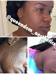 I'm not a content creator. I'm a Licensed Professional Esthetician & I  celebrated 10 years in business in March. I have ALOT of skin in the game  🏀 I'm not a Pandemic