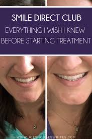 They need to help people enhance their own lives by aligning their own teeth about what clients say and they care. My Smiledirectclub Journey Everything You Need To Know About Invisiblealigners Adultbraces Smile Smile Direct Smiledirectclub Smile Direct Club Aligners